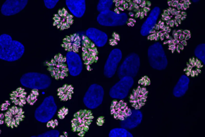 How the Toxoplasma parasite adapts to crowded conditions in host cells