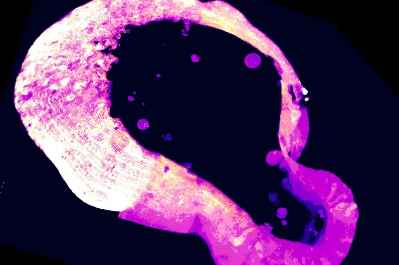 Cells use a little-known molecule to protect themselves from iron overload