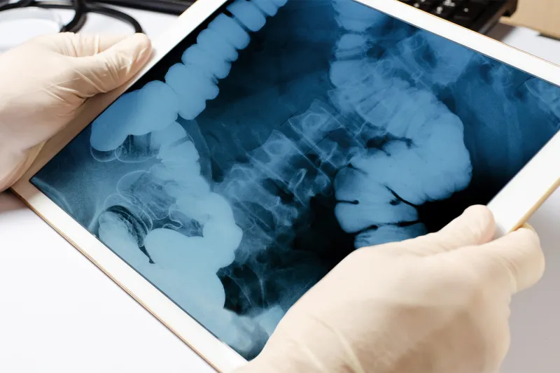 AI is helping pathologists find harmful lesions the eye can't see