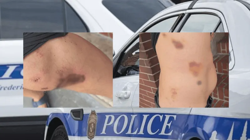 Frederick residents raise concerns over teen harassment, assaults