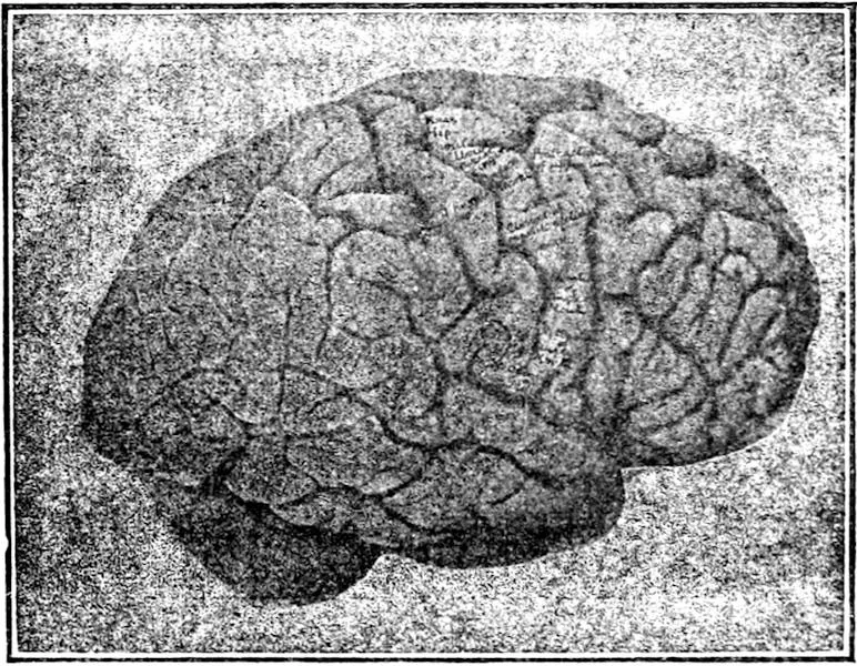 An index for brain activity: Dr. Sarma speaks on a Neural Health Index