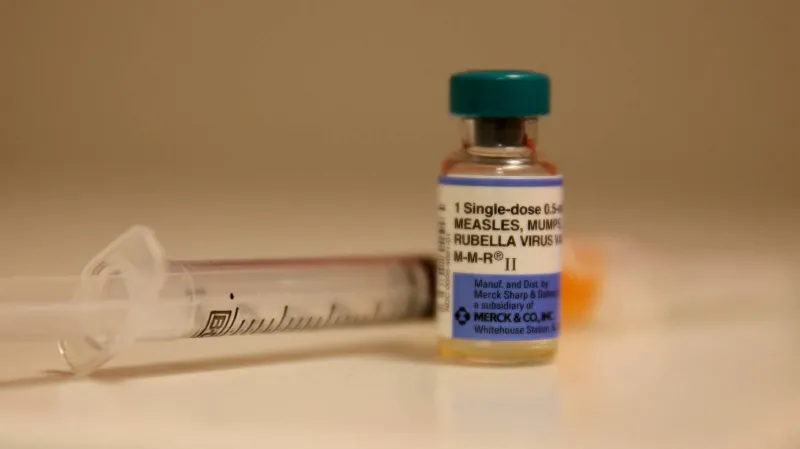State confirms measles in unvaccinated adult in SE Minn
