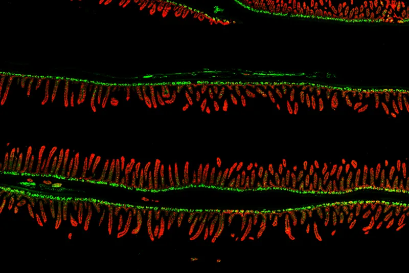Gut bacteria linked to malnutrition may pass to younger generations