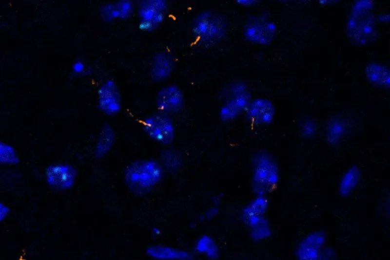 Skeletal muscle signals to brain, brown fat to control aging in mice