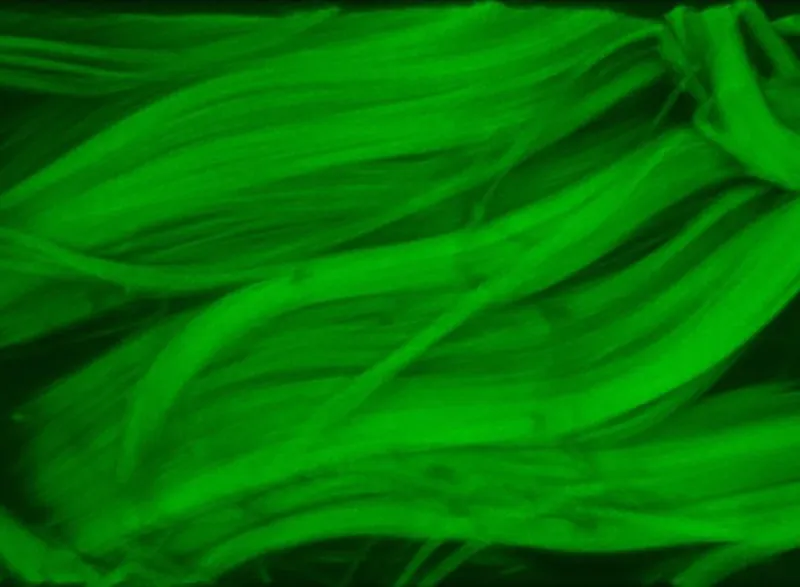 Tendon variations' effects on mechanics to get a closer look