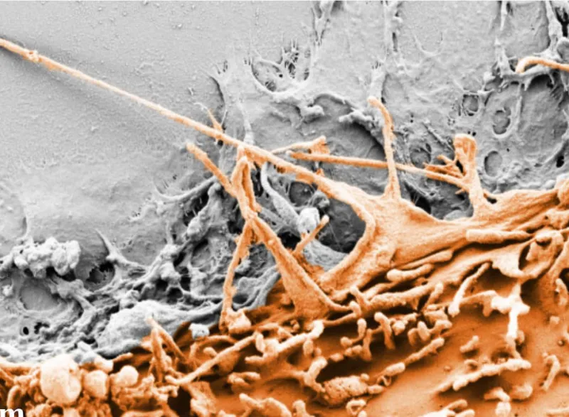 Tiny feet on cells sense defects, stall migration to heal wounds