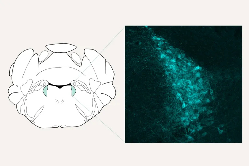 Scientists identify brain's brake that shuts off chronic pain