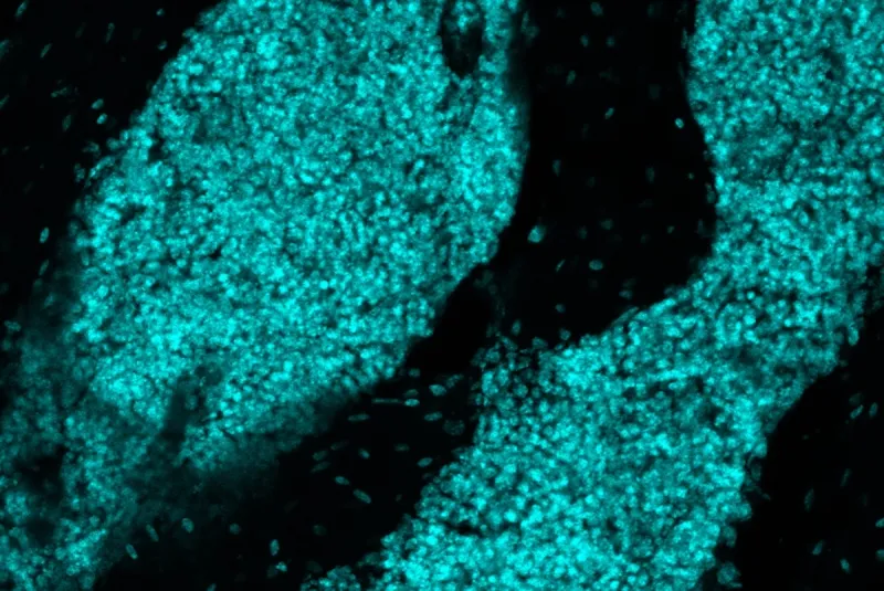 Newly found 'immune organ' inside skull directs brain defense