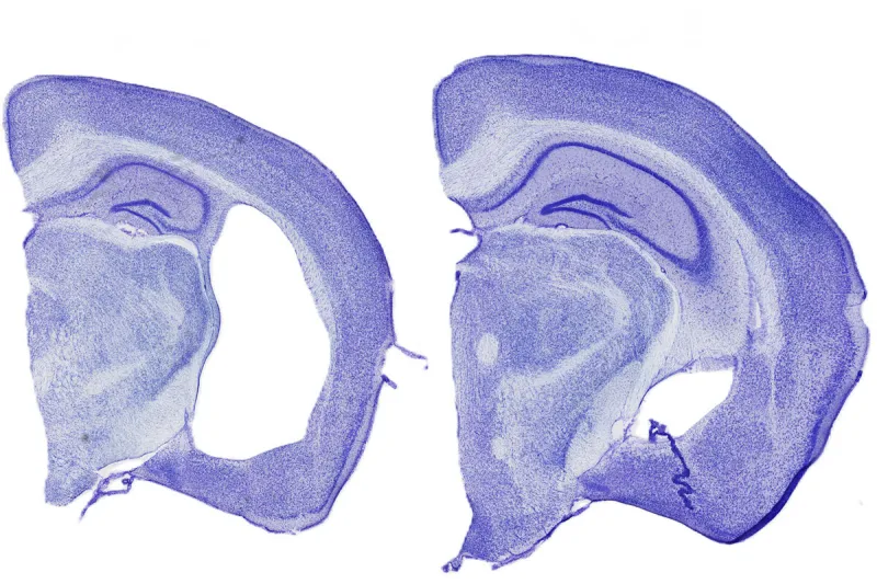 Key path to Alzheimer's-like brain damage starts outside the brain