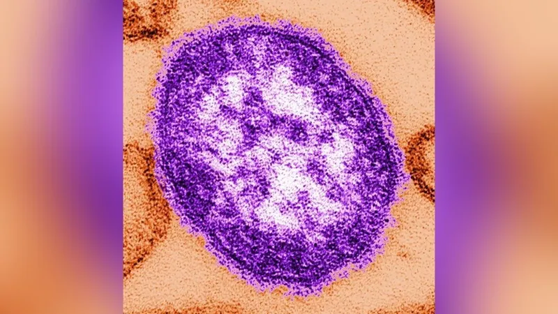 DHSS warns of measles exposure at Sedalia train station