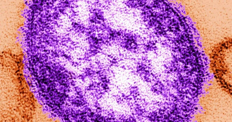 Measles exposure confirmed at Salt + Smoke in Edwardsville