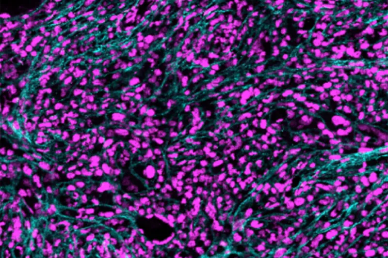 $11.7 million from NIH supports research on inflammation in blood cancers