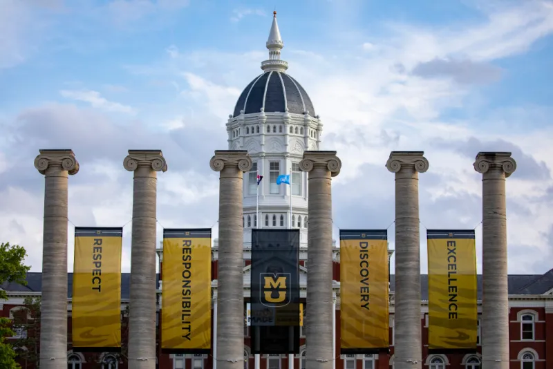 M-U Tiger player gets a heart transplant