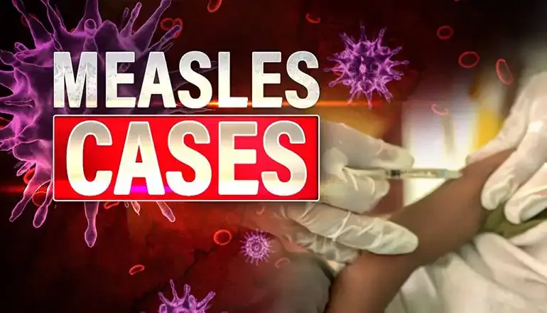Measles cases reach 4,080 for the year - the highest in decades