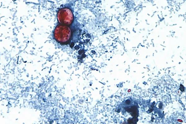 US health officials are investigating a new outbreak of cyclosporiasis