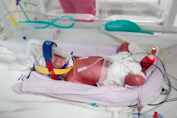 An Australian woman gives birth to rare identical quadruplet girls