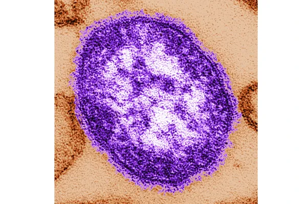 Pennsylvania's measles outbreak is the largest in decades in the US