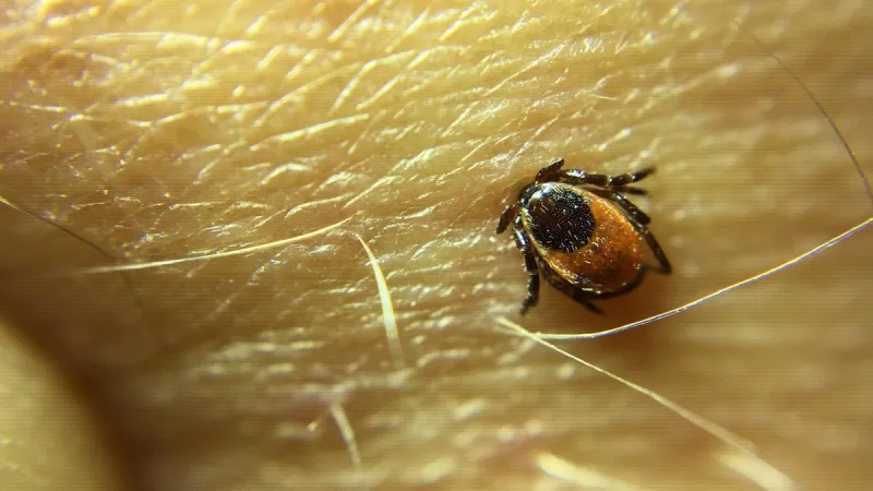Tick bites are surging in the US this year