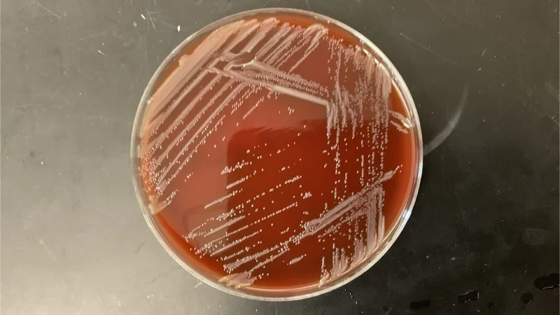 Tiny Microbe, Huge Potential -- Why Scientists are Studying a Microbe They Found in a Sink