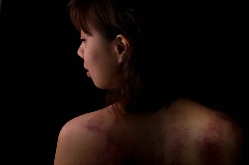 Domestic violence groups fear survivor services could disappear without warning