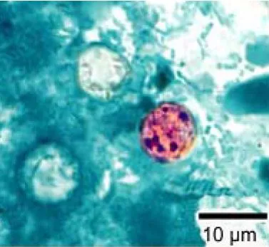 Parasitic infections likely linked to farming practices, not restaurants