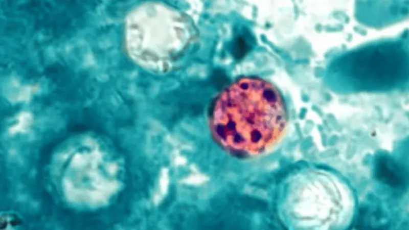 North Carolina cyclosporiasis cases climb to 718 as state launches tracking dashboard