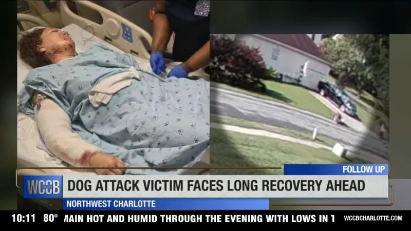 Charlotte woman mauled by seven dogs is out of hospital, faces long road to recovery