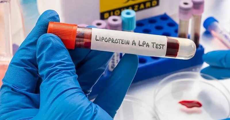 1 in 5 people may have this hidden genetic stroke risk