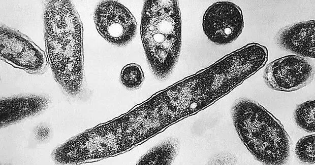 Legionnaires' disease making people sick on New York's Upper East Side