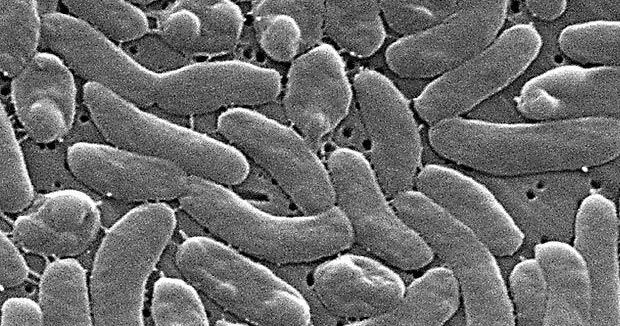 Officials caution Gulf Coast beachgoers during surge of deadly bacterial infections