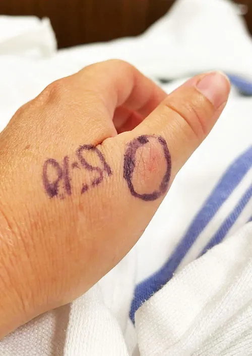 Sutherland woman triumphs over rattlesnake bite