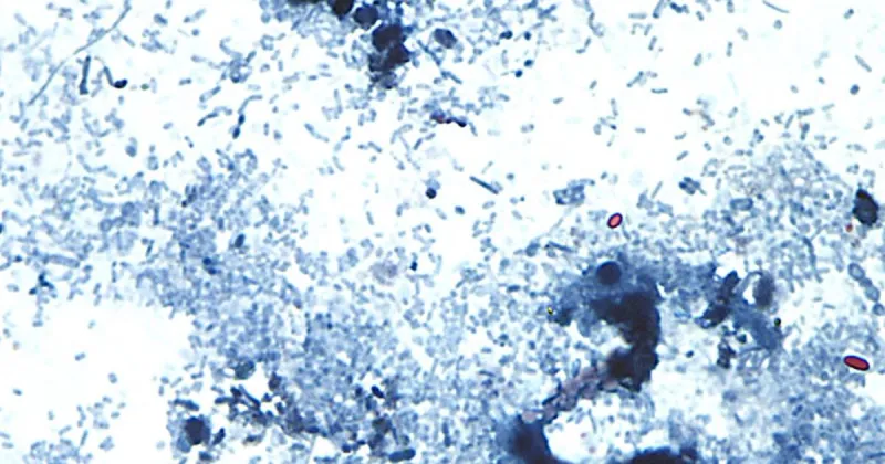 Health Department: 'No reason to be concerned' about diarrheal parasite in New Mexico