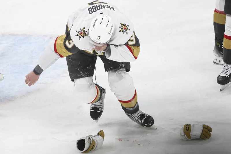 Golden Knights defenseman takes puck to the face, leaves Game 2