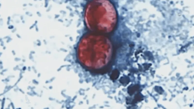 No confirmed Cyclosporiasis cases in Nevada amid rapid nationwide spread