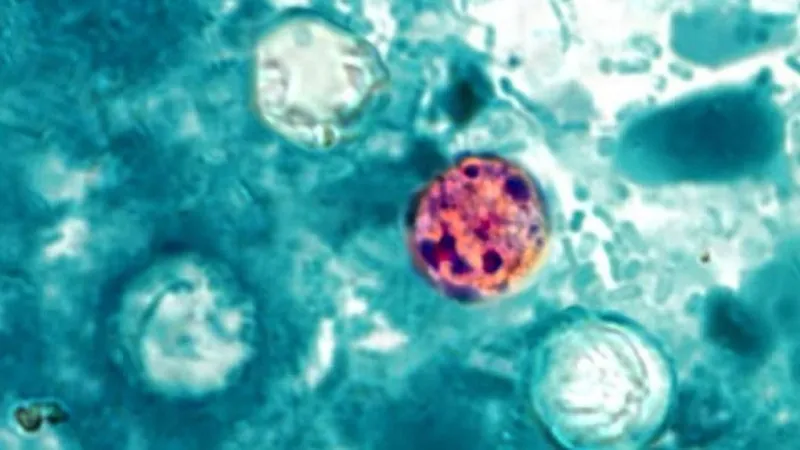 NNPH reports second cyclosporiasis case in Washoe County; travel likely source