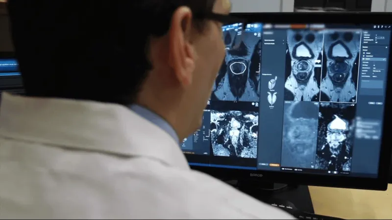 AI tools studied for prostate cancer diagnosis as local father battles disease