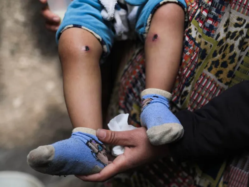 Don't Forget Gaza: 377,000 Missing, Half of Them Children