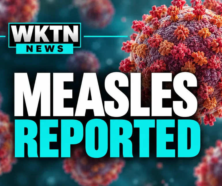Measles Case Confirmed in Hancock County with Multiple Exposure Locations