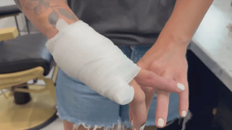 Fourth of July weekend brings surge of firework injuries to Green Country ERs