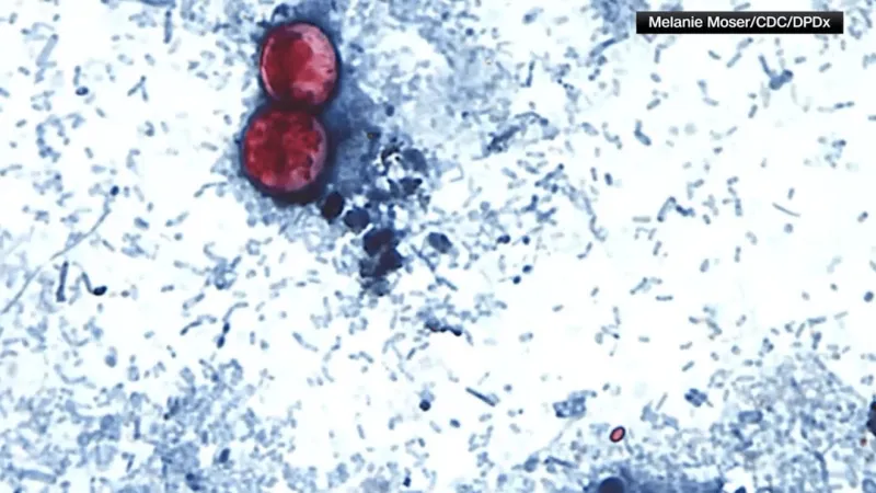 Local doctor shares what people in Green Country should know about cyclosporiasis