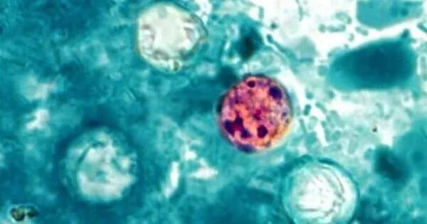 Cyclosporiasis cases jump to 300 in Oklahoma; experts worry more foodborne outbreaks are ahead