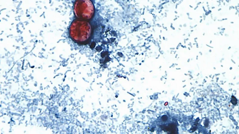 OSDH: Cyclosporiasis cases jump to 303 in Oklahoma