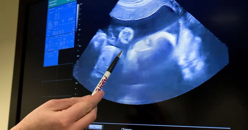 Women sue Oklahoma after traveling for abortions following fetal diagnoses