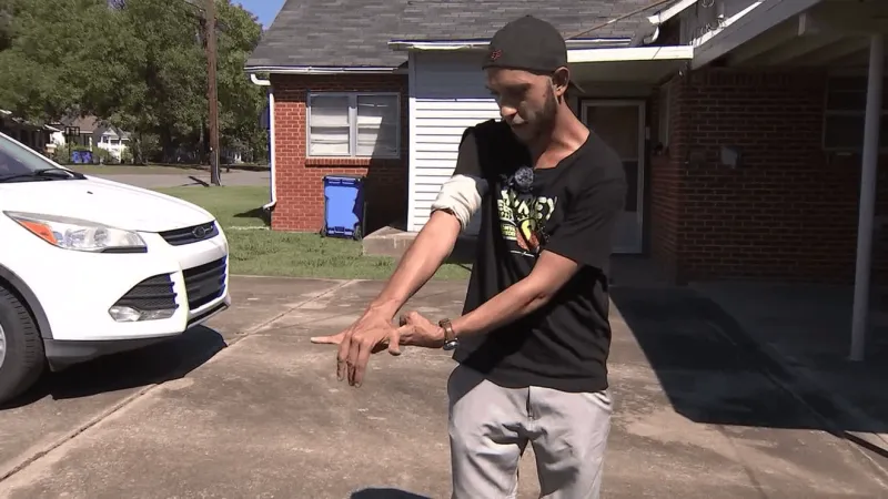 "I'm scarred" | Checotah DoorDash driver sent to ER after dog attack during delivery
