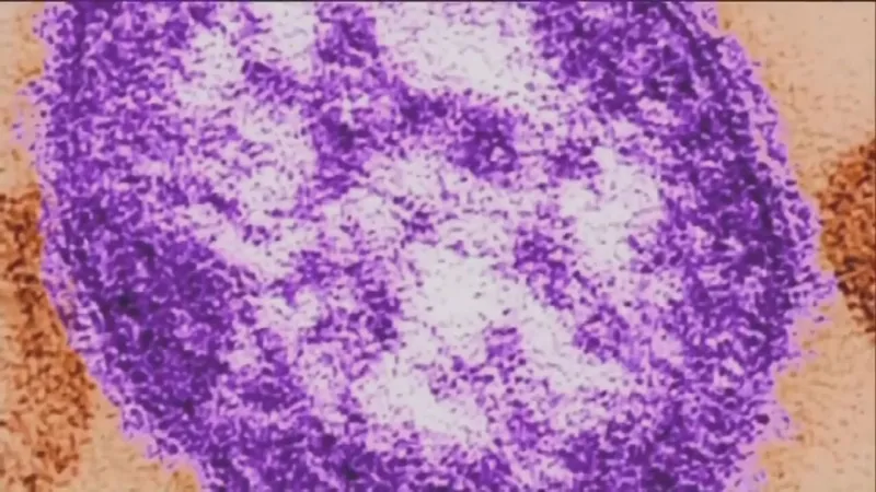 Randall Children's Hospital identified as measles exposure site
