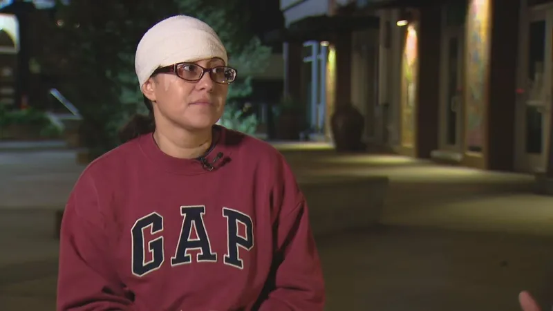 Seattle woman recounts having part of face bitten off by suspect in downtown