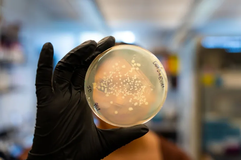 Seeking a better understanding of molecular activity in yeast and its link to improving human health