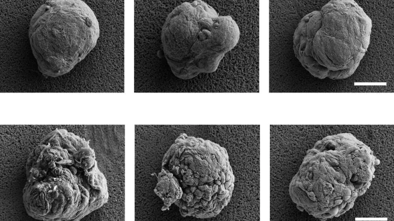 Cell 'invisibility cloaks' could offer side-effect-free diabetes treatment