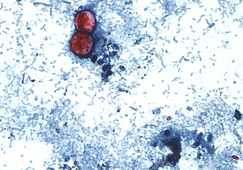 Mercer County woman sues Taylor Farms, Taco Bell over cyclosporiasis infection