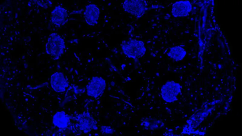 Genetic 'switches' could program 3D-printed bone tissue for blood vessel growth